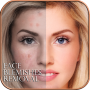 icon Face Blemishes Removal